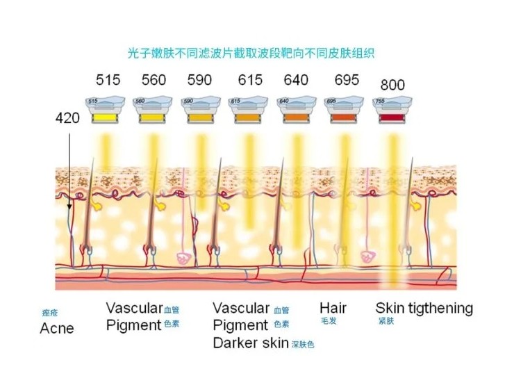 五大光子嫩膚技術(shù)（IPL、DPL、OPT、APT、BBL）及濾光片區(qū)別